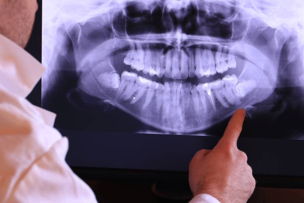 Best Holiday Emergency Dentist in Olivette, MO