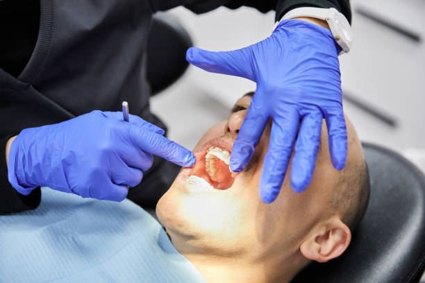 Best Emergency Root Canal Treatment in Olivette, MO