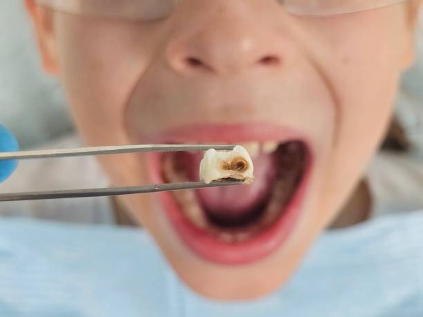 Best Emergency Dentist for Special Needs Patients in Olivette, MO
