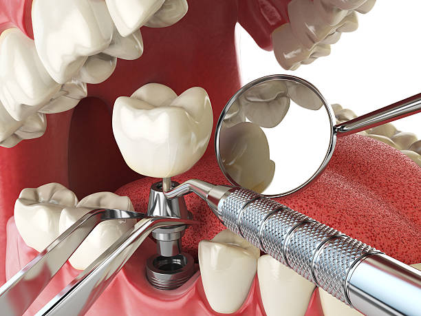 Best Emergency Cosmetic Dentistry in Olivette, MO